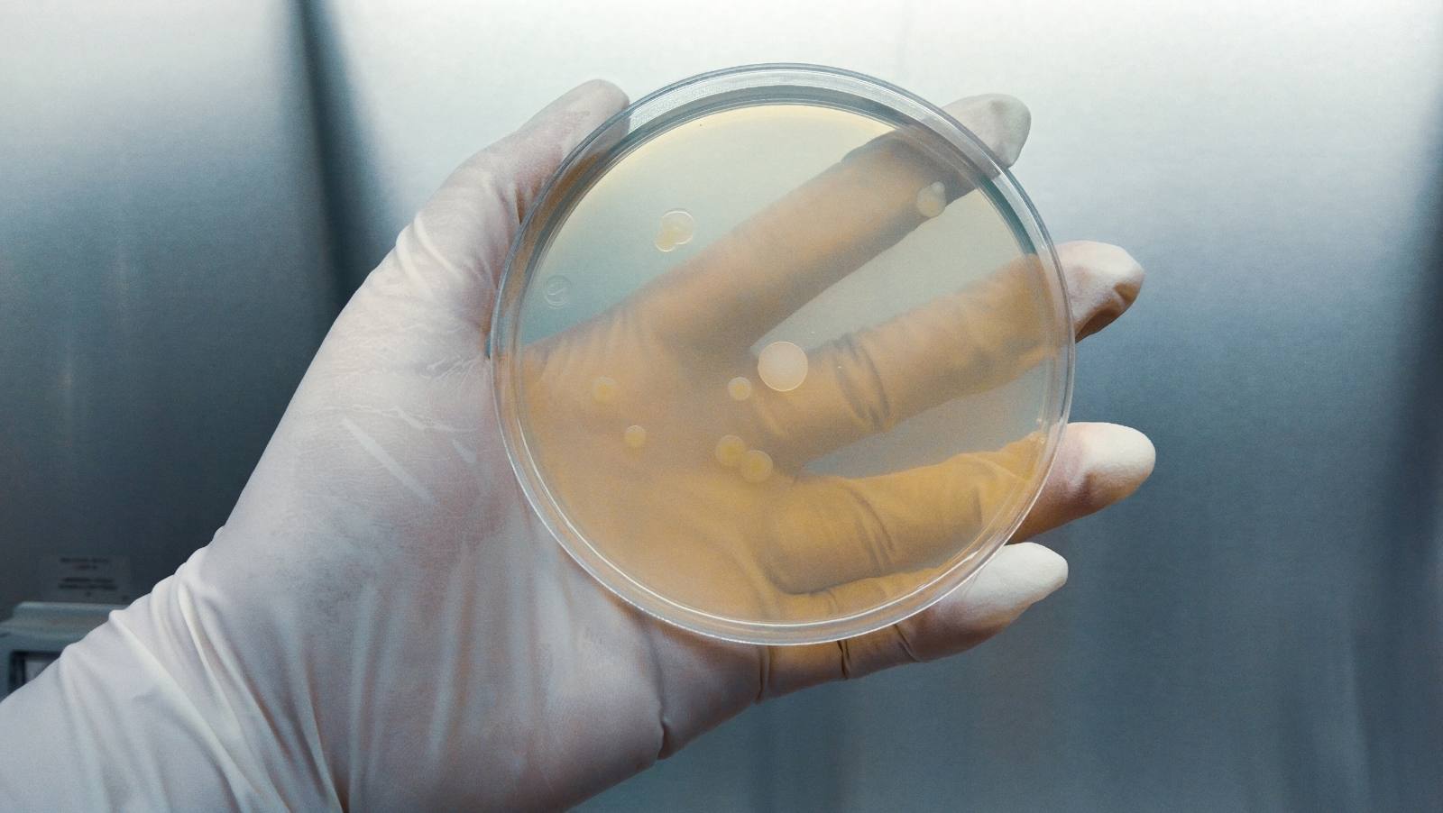 Gloved hand holding a petri dish